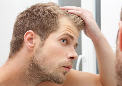 Les hommes et la perte de cheveux : Quelle solution ?