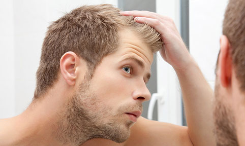 Les hommes et la perte de cheveux : Quelle solution ?