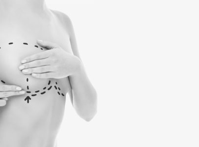 Les seins tombants et le soutien-gorge : osez le lifting mammaire !